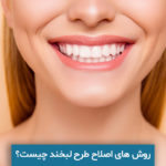 اصلاح طرح لبخند
