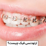 ارتودنسی فیک