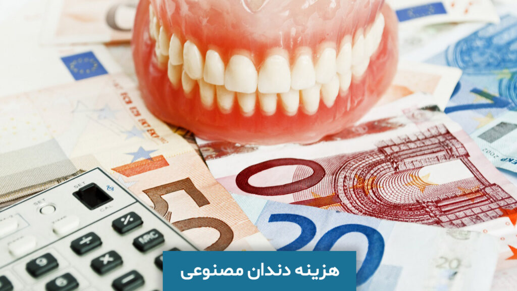 هزینه دندان مصنوعی