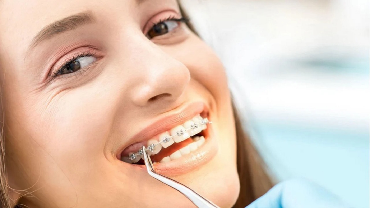 مراقبت از ارتودنسی دندان