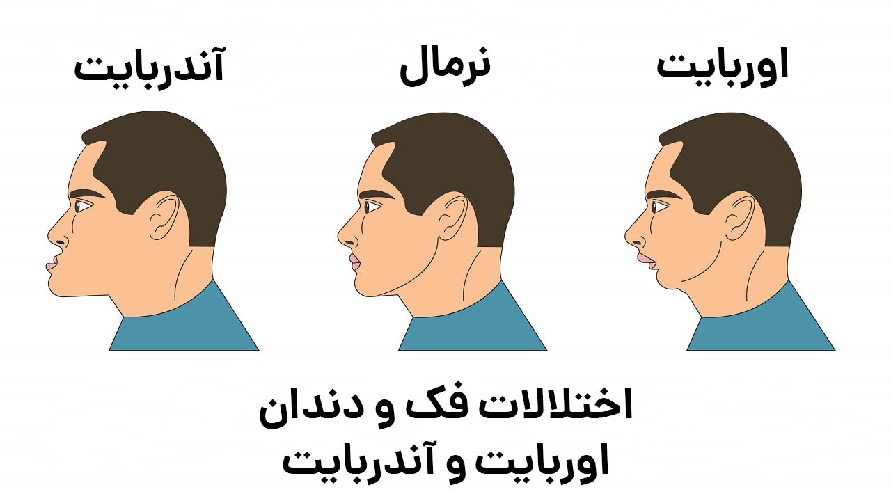 اختلالات-دندانی-و-فک