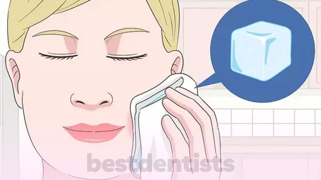کمپرس یخ برای بی حس کردن محل دندان درد