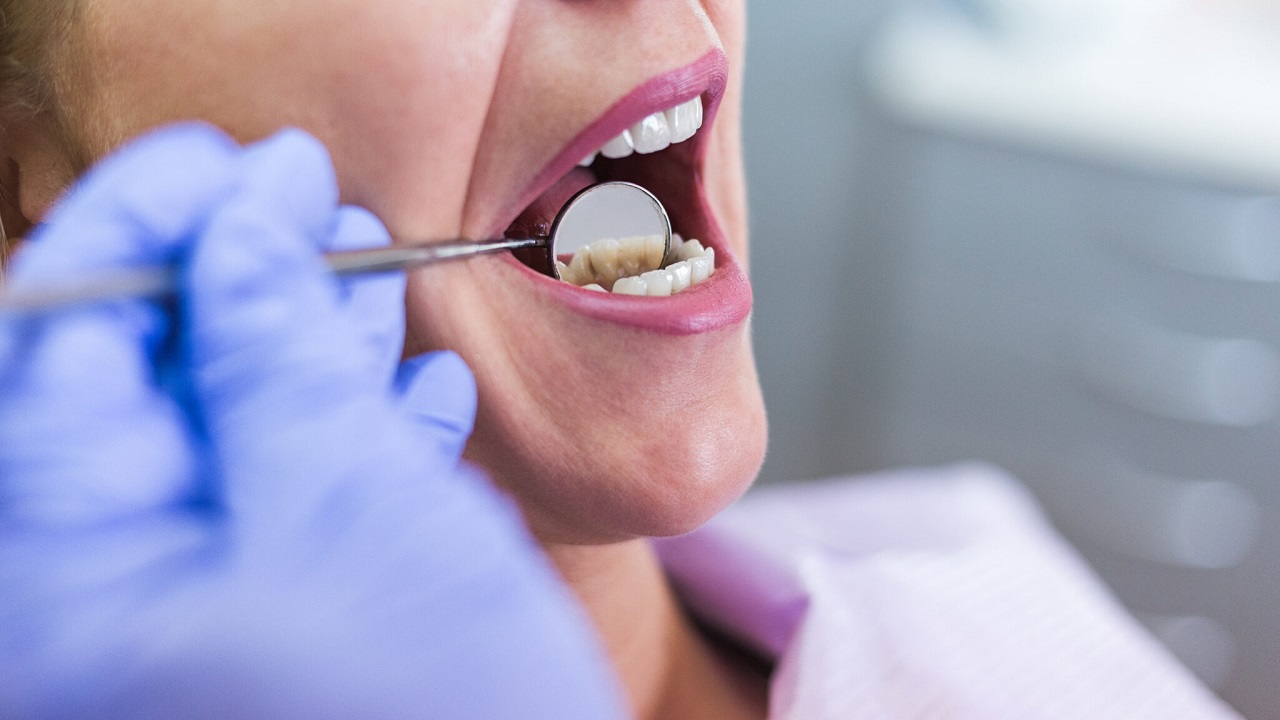 دندانپزشک متبحر و باتجربه برای درمان