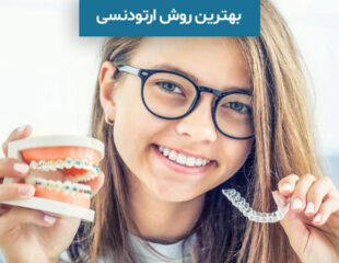 بهترین روش ارتودنسی