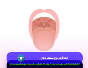 لکه قرمز روی سقف دهان