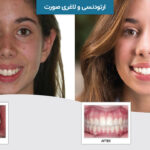 ارتودنسی و لاغری صورت