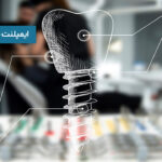 ایمپلنت دیجیتال