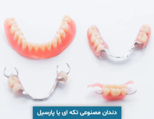 دندان مصنوعی تکه ای یا پارسیل