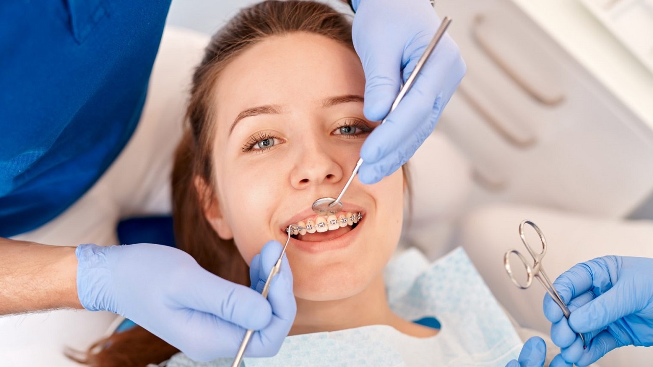نصب و بررسی ارتودنسی ثابت بر روی دندان بیمار