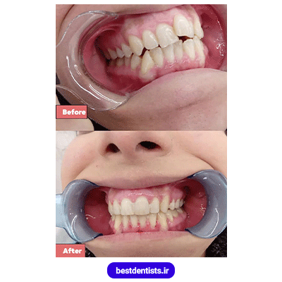 نمونه کار قبل و بعد دکتر امیربابک جمشیدی بروجردی شماره 2