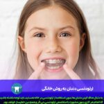 ارتودنسی دندان به روش خانگی
