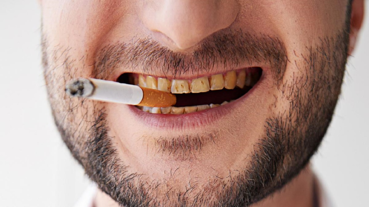 سیگار کشیدن و تغییر رنگ دندان