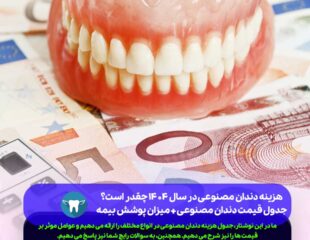 هزینه دندان مصنوعی