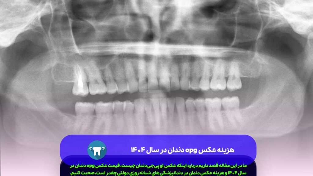 هزینه عکس opg دندان