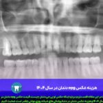 هزینه عکس opg دندان