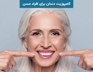 کامپوزیت دندان برای افراد مسن