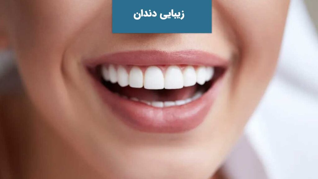 زیبایی دندان