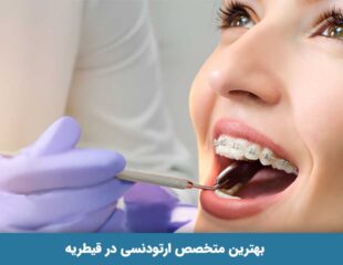 بهترین متخصص ارتودنسی در قیطریه