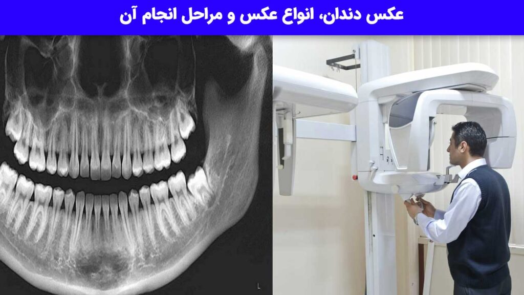 عکس دندان