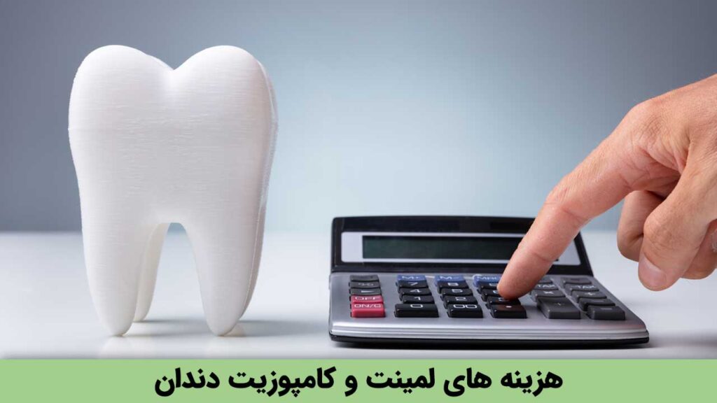 هزینه های لمینت و کامپوزیت دندان