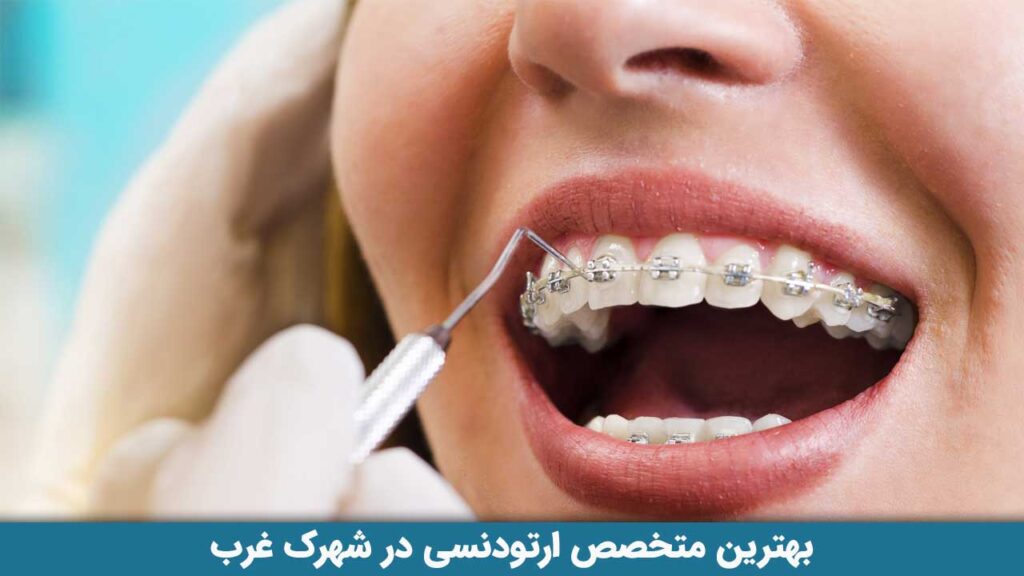 بهترین متخصص ارتودنسی در شهرک غرب