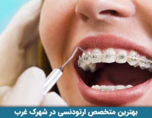 بهترین متخصص ارتودنسی در شهرک غرب