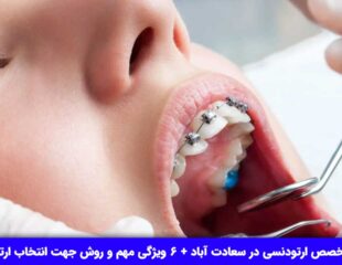 لیست متخصص ارتودنسی در سعادت آباد