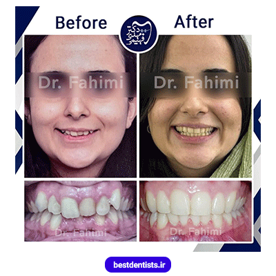 نمونه کار ارتودنسی دکتر مهدی فهیمی