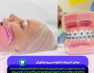 درمان خر و پف با ارتودنسی