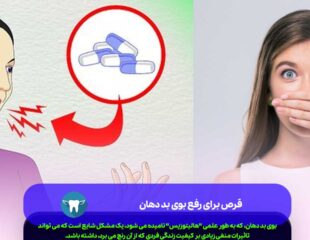 قرص برای رفع بوی بد دهان