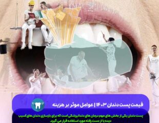 قیمت پست دندان