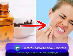 میخک برای دندان درد