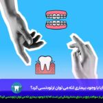 آیا با وجود بیماری لثه می توان ارتودنسی کرد؟
