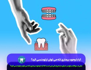 آیا با وجود بیماری لثه می توان ارتودنسی کرد؟