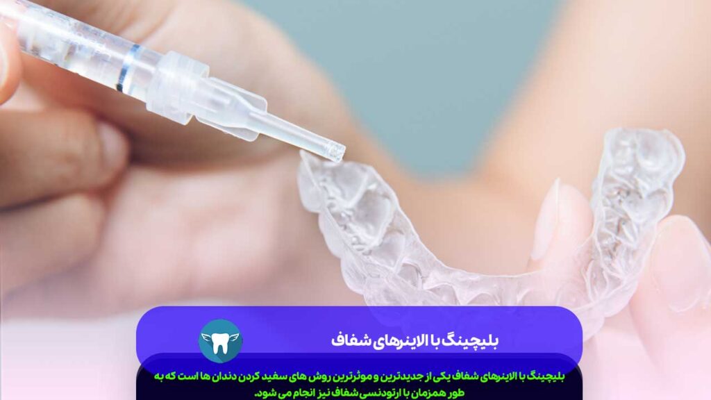 بلیچینگ با الاینرهای شفاف