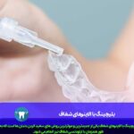 بلیچینگ با الاینرهای شفاف