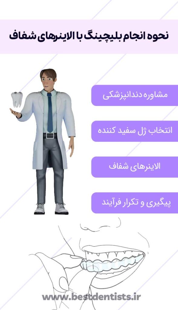 نحوه انجام بلیچینگ با الاینرهای شفاف