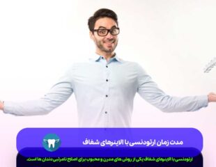 مدت زمان ارتودنسی با الاینرهای شفاف